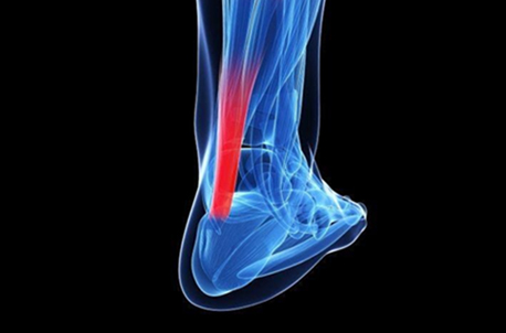 10 Things Not To Do If You Have Lower Limb Tendon Pain